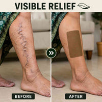 Varicose Vein Relief Patch – Fast Comfort for Heavy, Aching & Tired Legs