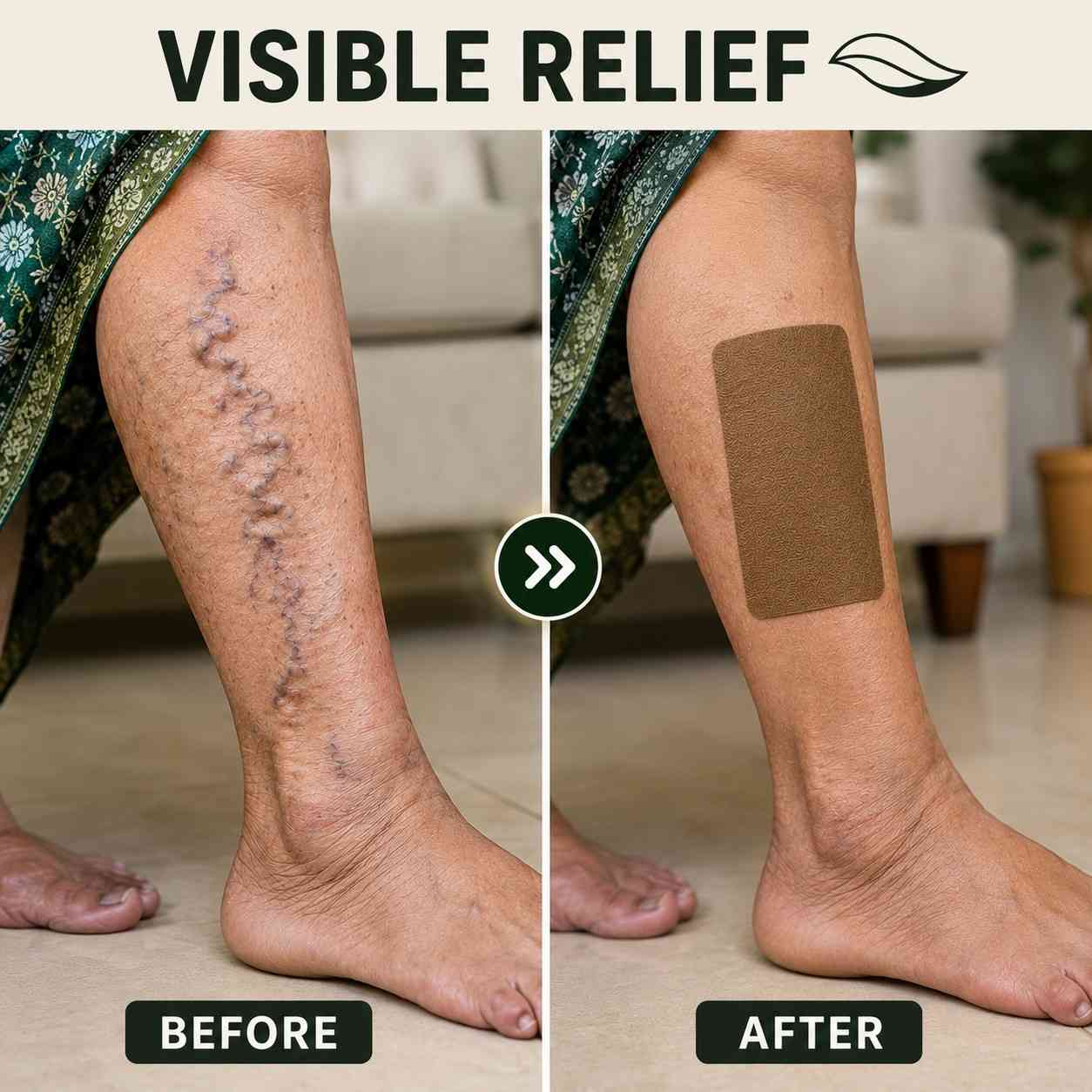Varicose Vein Relief Patch – Fast Comfort for Heavy, Aching & Tired Legs