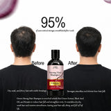 Onion Strong Hair Shampoo 100ml | Anti Hair Fall & Hair Strengthening Shampoo for Men & Women | Nourishing Daily Hair Care for Strong, Soft & Healthy Hair