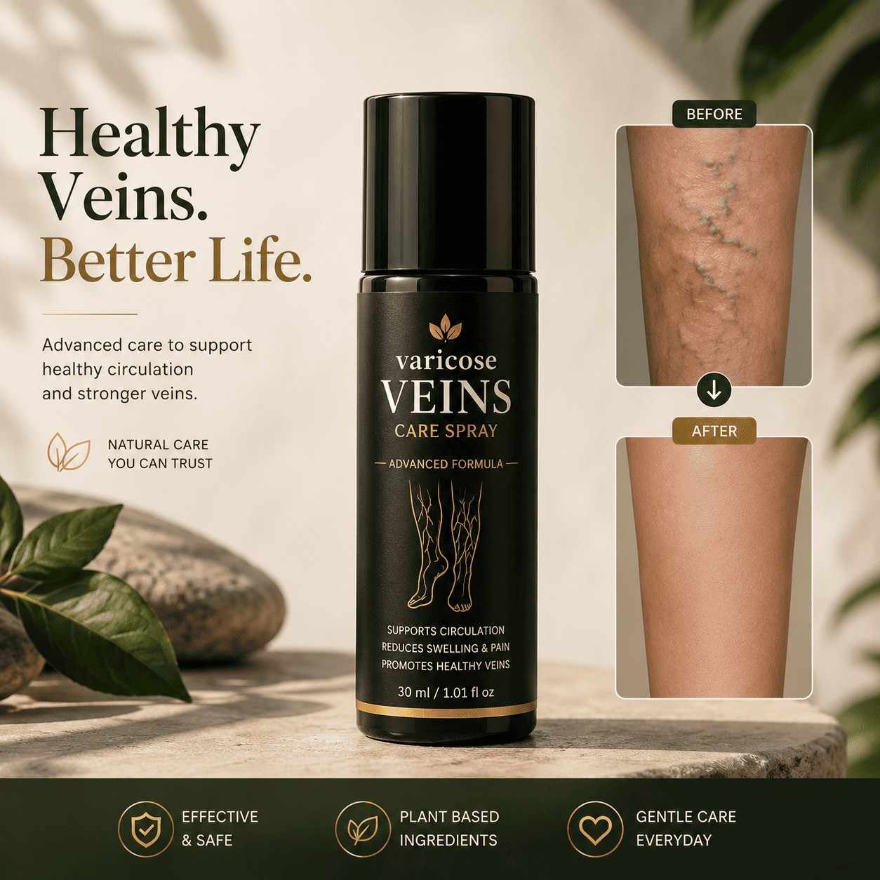 Pain Relief Spray - for Varicose Veins