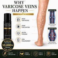 Pain Relief Spray - for Varicose Veins