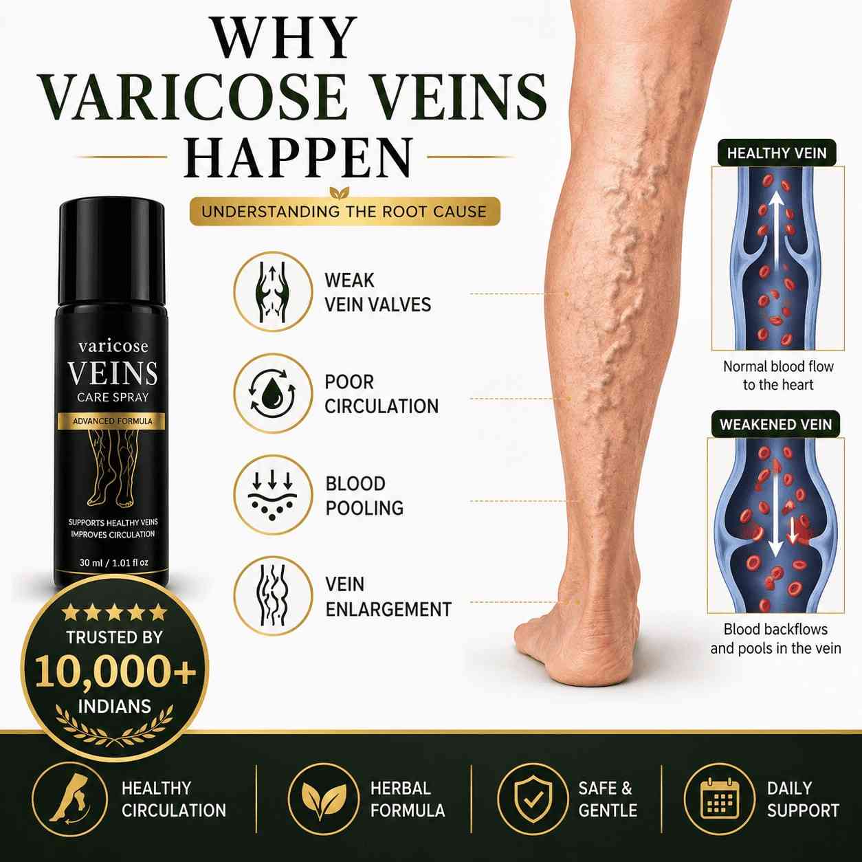 Pain Relief Spray - for Varicose Veins