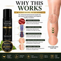 Pain Relief Spray - for Varicose Veins